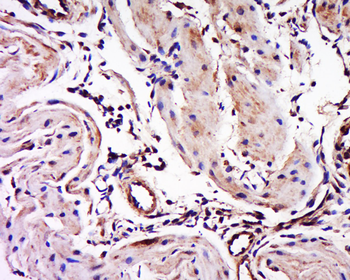 Myosin-3 Rabbit Polyclonal Antibody