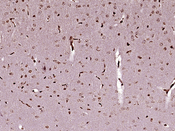 MAPKAP1/SIN1 Rabbit Polyclonal Antibody