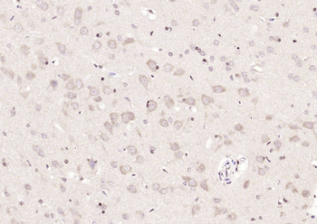 METTL3 Rabbit Polyclonal Antibody