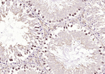 METTL3 Rabbit Polyclonal Antibody