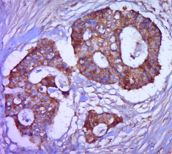 CD44v3 Rabbit Polyclonal Antibody