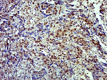 Phospho-MNK1 (Thr385) Rabbit Polyclonal Antibody