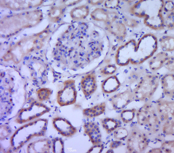 Phospho-MNK1 (Thr385) Rabbit Polyclonal Antibody