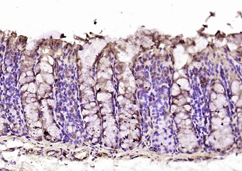 MPND Rabbit Polyclonal Antibody
