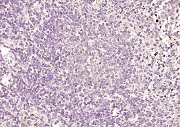 MPND Rabbit Polyclonal Antibody