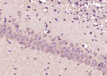 MPND Rabbit Polyclonal Antibody