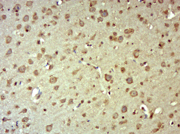MRPL2 Rabbit Polyclonal Antibody