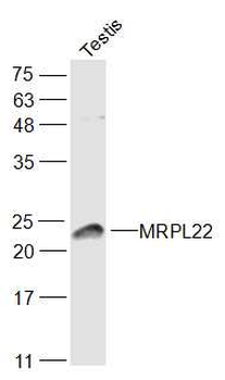 MRPL22 Rabbit Polyclonal Antibody