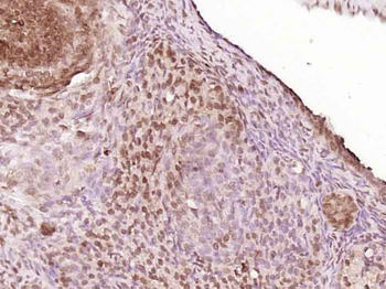 MSH4 Rabbit Polyclonal Antibody