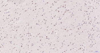 MT-ATP6 Rabbit Polyclonal Antibody