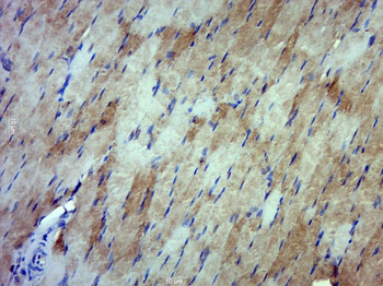 MTHFD2L Rabbit Polyclonal Antibody