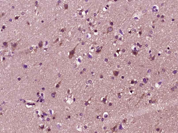 MACF1/ACF7 Rabbit Polyclonal Antibody