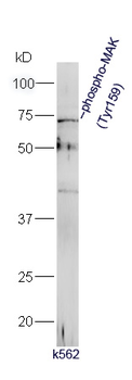 Phospho-MAK (Tyr159) Rabbit Polyclonal Antibody
