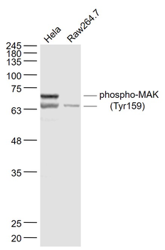 Phospho-MAK (Tyr159) Rabbit Polyclonal Antibody