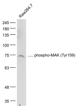Phospho-MAK (Tyr159) Rabbit Polyclonal Antibody