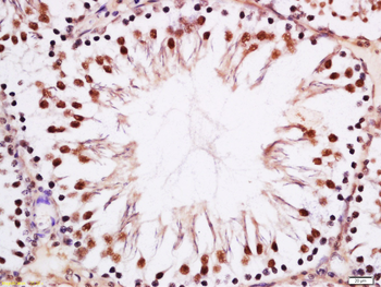 Phospho-MAK (Tyr159) Rabbit Polyclonal Antibody