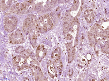 MCAF2 Rabbit Polyclonal Antibody