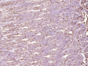 MCAF2 Rabbit Polyclonal Antibody