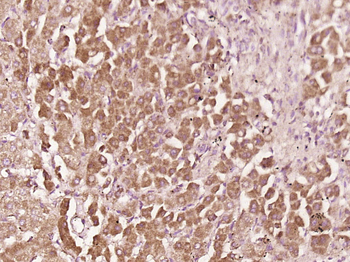 Phospho-MCAK (Ser95) Rabbit Polyclonal Antibody