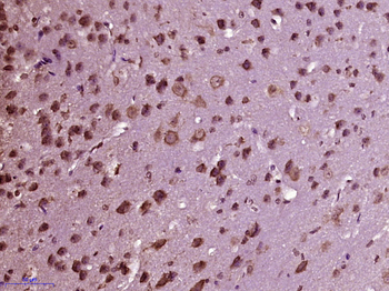 MDM1 Rabbit Polyclonal Antibody