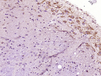 ME2 Rabbit Polyclonal Antibody