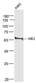 ME2 Rabbit Polyclonal Antibody
