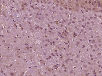 MED12/Trap230 Rabbit Polyclonal Antibody