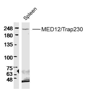 MED12/Trap230 Rabbit Polyclonal Antibody
