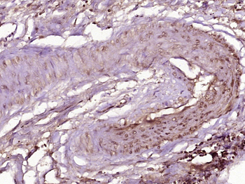 MED18 Rabbit Polyclonal Antibody