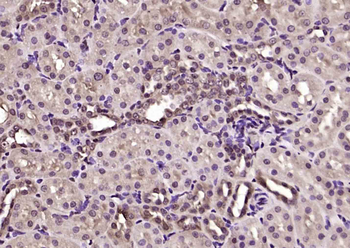 MED19/LCMR1 Rabbit Polyclonal Antibody