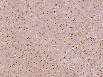 MED28 Rabbit Polyclonal Antibody