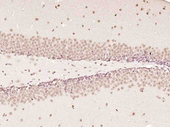 MED4 Rabbit Polyclonal Antibody
