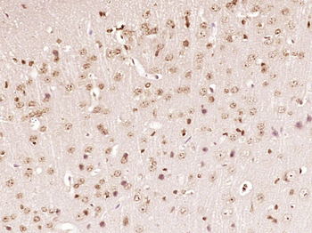 MED8 Rabbit Polyclonal Antibody