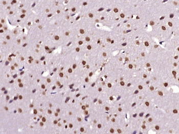MED9 Rabbit Polyclonal Antibody