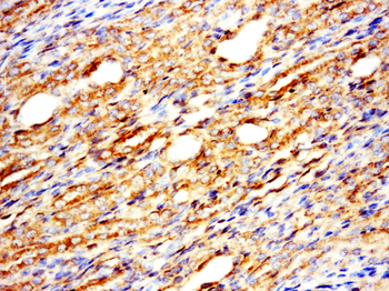 Melanophilin Rabbit Polyclonal Antibody