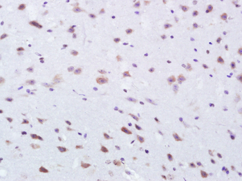 Methionine Aminopeptidase 2 Rabbit Polyclonal Antibody