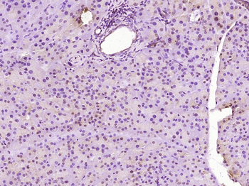 METTL1 Rabbit Polyclonal Antibody