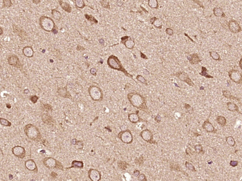 MEX3D/RNF193 Rabbit Polyclonal Antibody