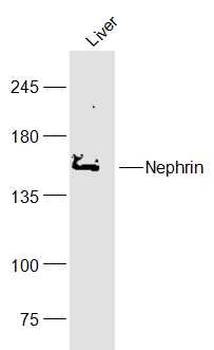 Nephrin Rabbit Polyclonal Antibody