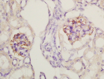 Nephrin Rabbit Polyclonal Antibody