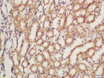 Nephrin Rabbit Polyclonal Antibody