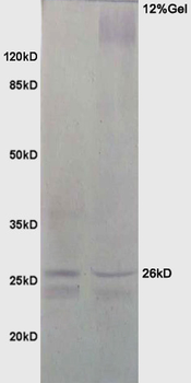 NQO2 Rabbit Polyclonal Antibody