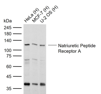 Natriuretic Peptide Receptor A Rabbit Polyclonal Antibody