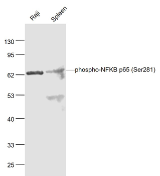 Phospho-NFKB p65 (Ser281) Rabbit Polyclonal Antibody