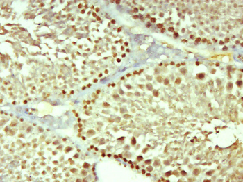 OTUD1 Rabbit Polyclonal Antibody