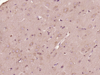 OTUD1 Rabbit Polyclonal Antibody