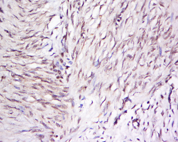 OTUD5/DUBA Rabbit Polyclonal Antibody