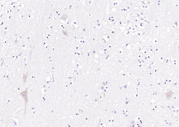 OXR1 Rabbit Polyclonal Antibody