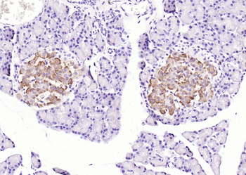 OXR1 Rabbit Polyclonal Antibody