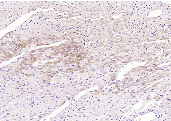 OXR1 Rabbit Polyclonal Antibody